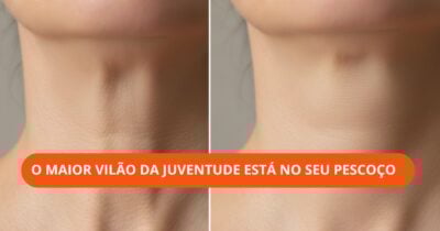 Dicas para cuidar da região do pescoço (Foto: Montagem TV Foco / GMN)