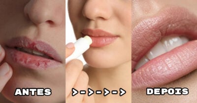 Veja quais são os truques indicados para acabar com os lábios rachados (Foto: Divulgação)