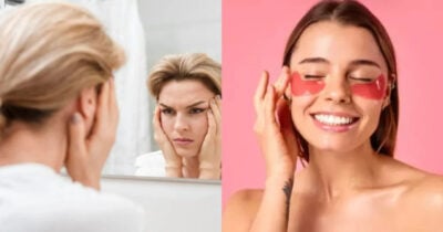 As 5 dicas infalíveis para eliminar as olheiras de vez (Foto: Divulgação)