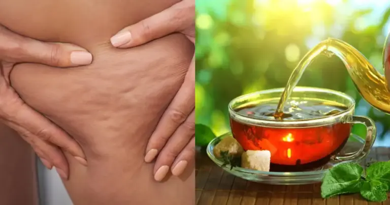 Chá com 2 ingredientes tem efeito termogênico e ajuda a combater a celulite