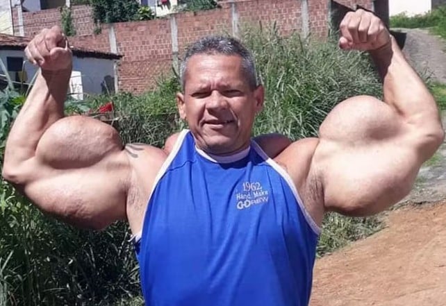 Popeye Brasileiro' morreu no Recife (Foto: Reprodução / Redes sociais)

