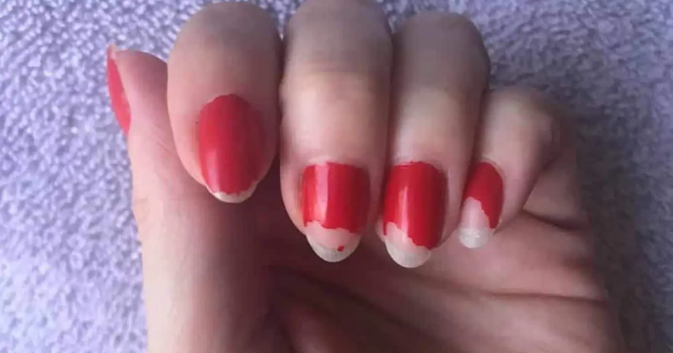 Esmalte descascando - Foto Internet