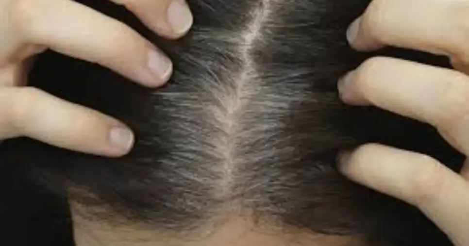 Saiba o que fazer para cobrir seus cabelos brancos em casa (Foto: Divulgação) Saiba o que fazer para cobrir seus cabelos brancos em casa (Foto: Divulgação)