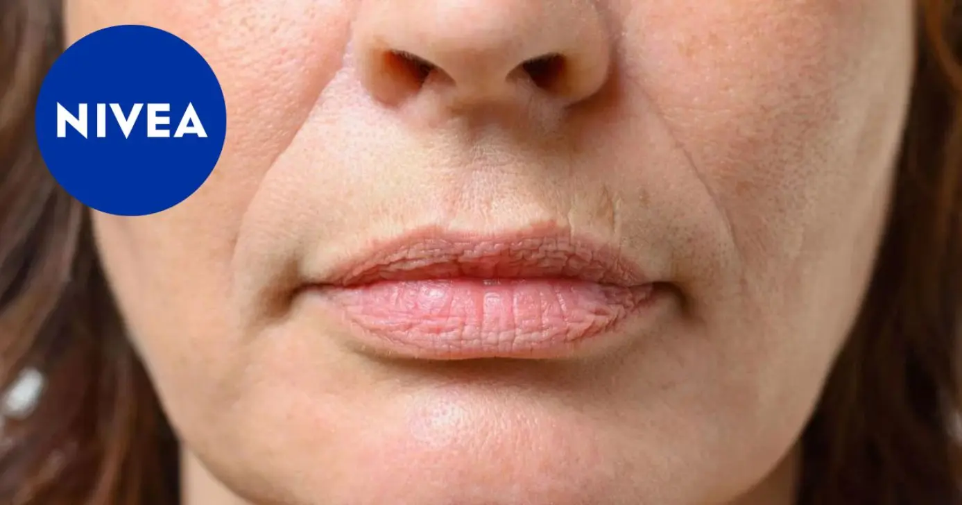 Efeito preenchedor: Como reduzir o bigode chinês com exercícios e creme da Nivea (Foto Reprodução/Montagem/TV Foco/Canva/Paola)