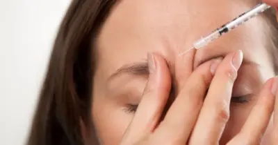 Os 3 truques de beleza para evitar rugas na testa sem precisar gastar com botox