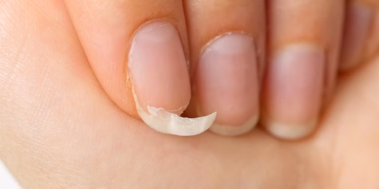 Como evitar unhas quebradiças e fracas para quem lava louça todo dia Como evitar unhas quebradiças e fracas para quem lava louça todo dia
