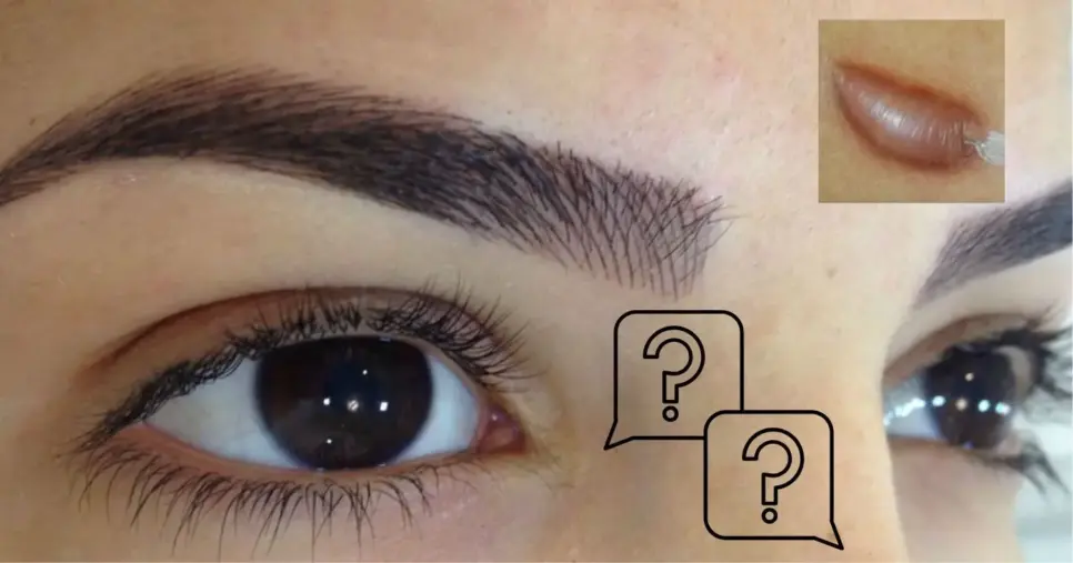 Micropigmentação na sobrancelha: Quem tem queloide pode fazer? (Foto Reprodução/Montagem/TV Foco/Canva/Paola) Micropigmentação na sobrancelha: Quem tem queloide pode fazer? (Foto Reprodução/Montagem/TV Foco/Canva/Paola)