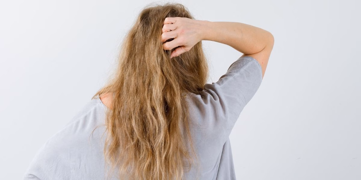 Cabelo seco causado por falta de oleosidade (Reprodução: Divulgação)