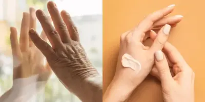 Mãos envelhecem de forma precoce e intensa: Como protegê-las e evitar surgimento de rugas