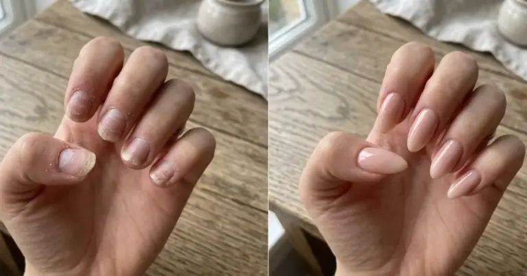 5 hábitos comuns que deixam unhas quebradiças, finas e descamando 5 hábitos comuns que deixam unhas quebradiças, finas e descamando