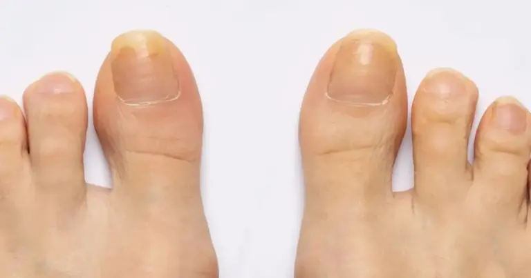 Unhas dos pés de rica: Truque com esmalte deixa até as curtas com acabamento de salão Unhas dos pés de rica: Truque com esmalte deixa até as curtas com acabamento de salão