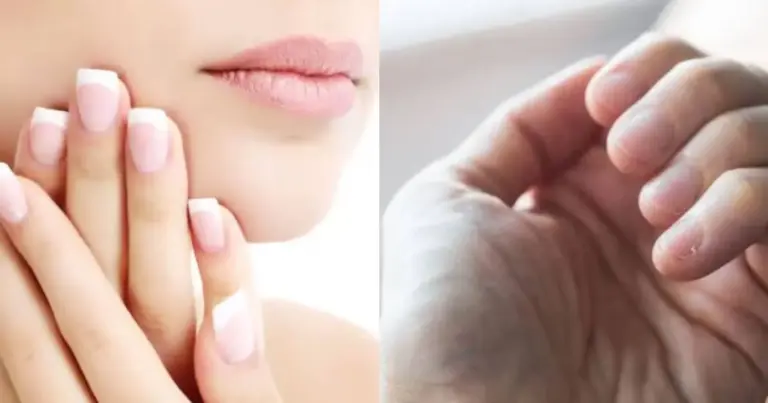 Unhas fracas e quebradiças: como fortalecer de forma natural e eficaz em casa Unhas fracas e quebradiças: como fortalecer de forma natural e eficaz em casa