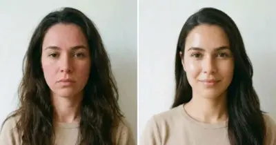 Usa ácidos, mas sua pele está sempre irritada? Veja o que fazer