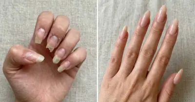 Unhas fortes e impecáveis: 3 produtos evitam quebras por até R$ 30