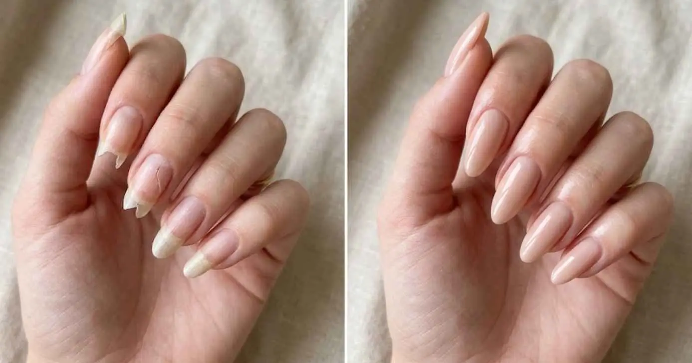 Ilustração antes e depois de unhas quebradas (Foto: Montagem TV Foco / GMN)