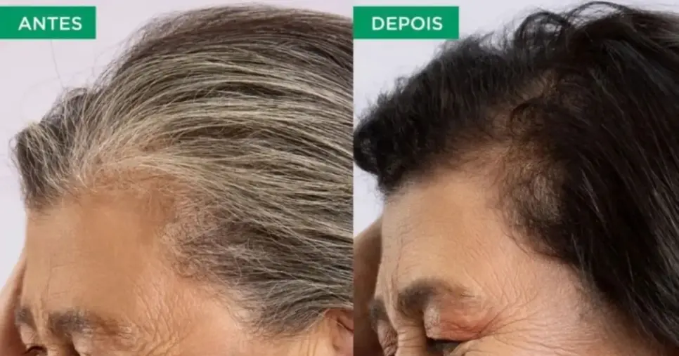 Resultado antes e depois do tonalizante (Foto Reprodução/Montagem/TV Foco/Google Shopping) Resultado antes e depois do tonalizante (Foto Reprodução/Montagem/TV Foco/Google Shopping)