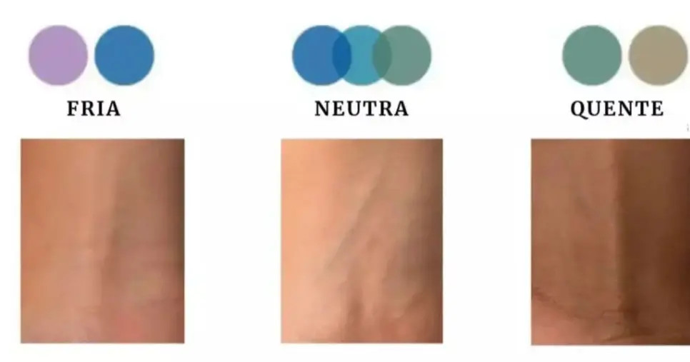 Veias Veias